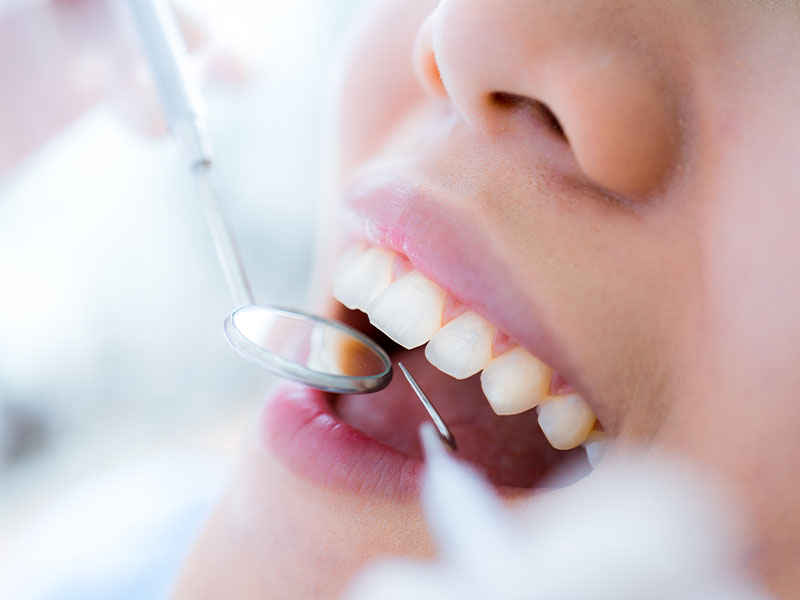 Basic periodontal treatment