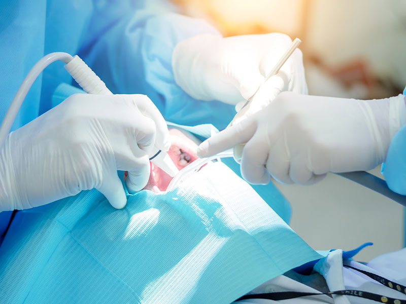 Basic periodontal treatment