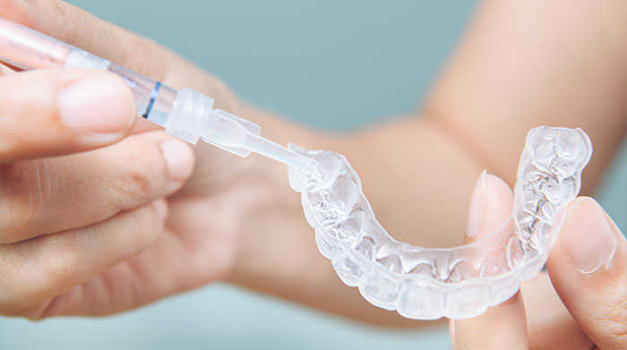 home whitening