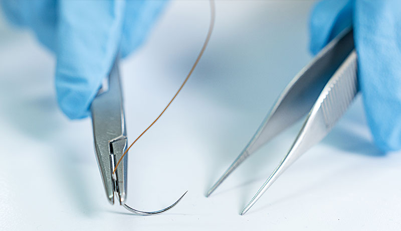 suture