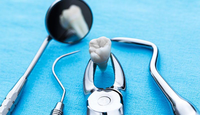 Wisdom teeth extraction
