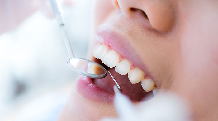 Pain-Friendly Tooth Extraction