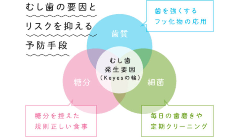 虫歯治療について